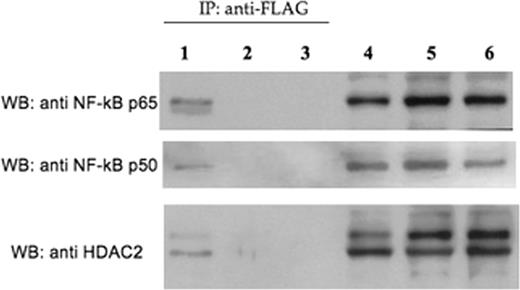 Figure 1. Western blot analysis with anti-p65, anti-p50 and anti-HDAC2 antibodies on protein extracts from K562 transfected with p3xFLAG-CSDA a (lanes 1 and 4), p3xFLAG-CSDA b (lanes 2 and 5) or p3xFLAG (lanes 3 and 6) immunoprecipitated with an anti-FLAG antibody (lanes 1, 2, 3) or not immunoprecipitated (lanes 4, 5, 6).