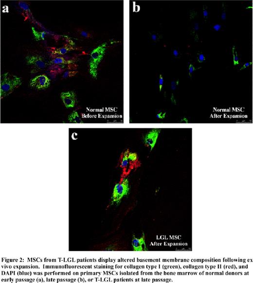 Figure 2:. MSCs from T-LGL patients display altered basement membrane composition following ex vivo expansion. Immunofluorescent staining for collagen type I (green), collagen type II (red), and DAPI (blue) was performed on primary MSCs isolated from the bone marrow of normal donors at early passage (a), late passage (b), or T-LGL patients at late passage.