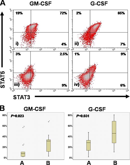 Figure 1. Significantly lower pretreatment levels of STAT3+STAT5+ MDS progenitors after G and GM-CSF stimulation in responding patients. . / (A) Representative plots of a patient who failed azacytidine (i, ii) and one who achieved CR (iii, iv). (B) Cumulative results in responding (A) and non-responding (B) patients.