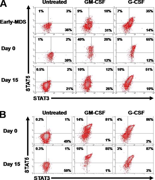 Figure 2. The kinetics of SPs follow the response to azacytidine. . / (A) The SP of a late-stage MDS patient who attained PR reverted to early-stage MDS levels at day 15 after the first cycle of azacytidine. (B) By contrast, a patient who failed treatment displayed no SP changes.
