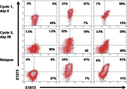 Figure 3. Kinetics of the SP in a relapsing patient . / Plots of a patient who achieved CR but relapsed 4 months after the discontinuation of azacytidine.