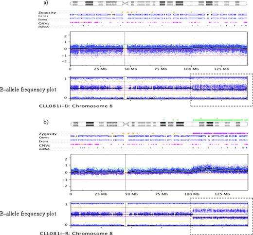 Fig .1. CNA and B-allele frequency plots of pre-treatment and relapse samples of a patient demonstrating clonal evolution. A low level of cnLOH can be seen in the B-allele frequency plot at diagnosis (a) at the end of chromosome 8 (dashed box) which becomes more apparent at relapse (b).