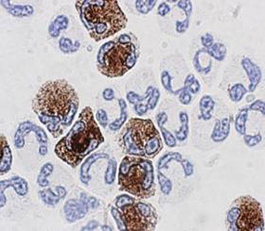 Figure 2. Immunohistochemistry of OLFM4 in neutrophils.