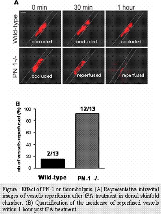 Figure :. Effect of PN-1 on thrombolysis. (A) Representative intravital images of vessels reperfusion after tPA treatment in dorsal skinfold chamber. (B) Quantification of the incidence of reperfused vessels within 1 hour post tPA treatment