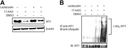 Figure 4. 17-AAG promotes ubiquitination and proteasome-dependent degradation of WT1. (A) K562 cells were treated with 10μM 17-AAG alone, 10μM lactacystin alone or with a combination of both agents for 24 hours, and cell lysates were subjected to Western blot analysis using anti-WT1 and anti–β-actin. (B) K562 cells were treated as above for 8 hours, and proteins extracts were immunoprecipitated (IP) with anti-WT1. The ubiquitination of WT1 was analyzed by Western blotting (IB) with anti-ubiquitin (top panel), and WT1 protein levels were assessed by anti-WT1 (bottom panel).