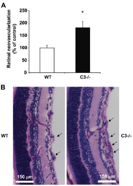 Figure 1. C3 deficiency results in increased angiogenesis in ROP. WT or C3−/− mice were subjected to the ROP model. (A) Retinal neovascularization was quantified on day p17 in WT and C3−/− mice as described under “Hypoxia-induced retinal vascularization, retinopathy of prematurity model.” Retinal neovascularization is presented as the number of epiretinal neovascular nuclei per section. Data are mean ± SEM (n = 12-16 pups per group) and are shown as percentage of control. Number of epiretinal nuclei in WT mice represents the 100% control. *P < .001. (B) Paraffin-embedded axial sections (6 μm) of the retina were stained with PAS and hematoxylin. Pathological neovascularization invades into the vitreous cavity anterior to the internal limiting membrane. C3−/− mice subjected to the ROP model had more neovascular regions anterior to the internal limiting membrane compared with WT mice. The arrows indicate the neovascular tufts anterior to the internal limiting membrane. Scale bars, 150 μm.