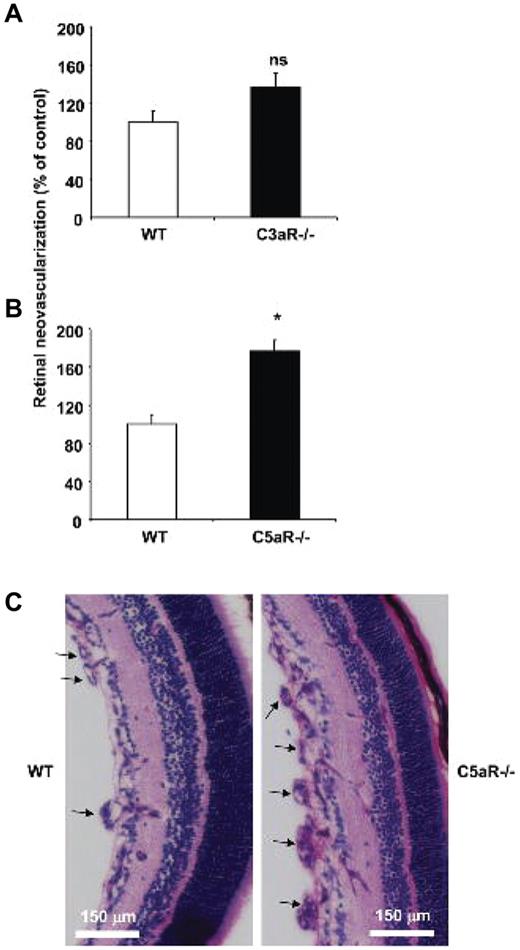 Figure 2. C5a receptor deficiency results in increased angiogenesis in ROP. WT, C3aR−/−, or C5aR−/− mice were subjected to the ROP model. (A) Retinal neovascularization was quantified on day p17 in WT and C3aR−/− mice. Retinal neovascularization is presented as the number of epiretinal neovascular nuclei per section. Data are mean ± SEM (n = 12-13 pups per group) and are shown as percentage of control. Number of epiretinal nuclei in WT mice represents the 100% control. There was no significant difference between both groups. (B) Retinal neovascularization was quantified on day p17 in WT and C5aR−/− mice. Data are mean ± SEM (n = 16-17 pups per group) and are shown as percentage of control. Number of epiretinal nuclei in WT mice represents the 100% control. *P < .005. (C) Paraffin-embedded axial sections (6 μm) of the retina were stained with PAS and hematoxylin, and neovascular tufts were observed anterior to the internal limiting membrane (arrows). C5aR−/− mice displayed more neovascular tufts. Scale bars, 150 μm.