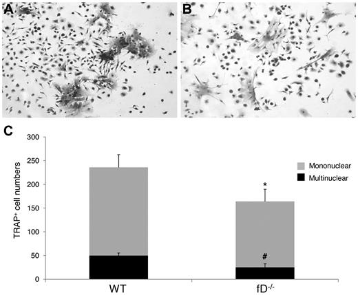 Figure 4. The alternative pathway of complement activation is required efficient OC differentiation. Aliquots of 2 × 106 WT and factor D−/− BM cells were cultured in α-MEM/10% heat-inactivated FBS media in each well of a 24-well plate together with 1 × 10−8M 1,25(OH)2 vitamin D3. OCs were stained, and TRAP-positive cells in each well were counted under a microscope. Panels show representative TRAP-positive cells from WT (A), factor D−/− (B) BM cells, and total mononuclear (mono)/multinucleated (multi) TRAP-positive cells in each well (C). Results are representative from 2 independent experiments performed in triplicates. Data are mean ± SD: *P < .05, #P < .05.