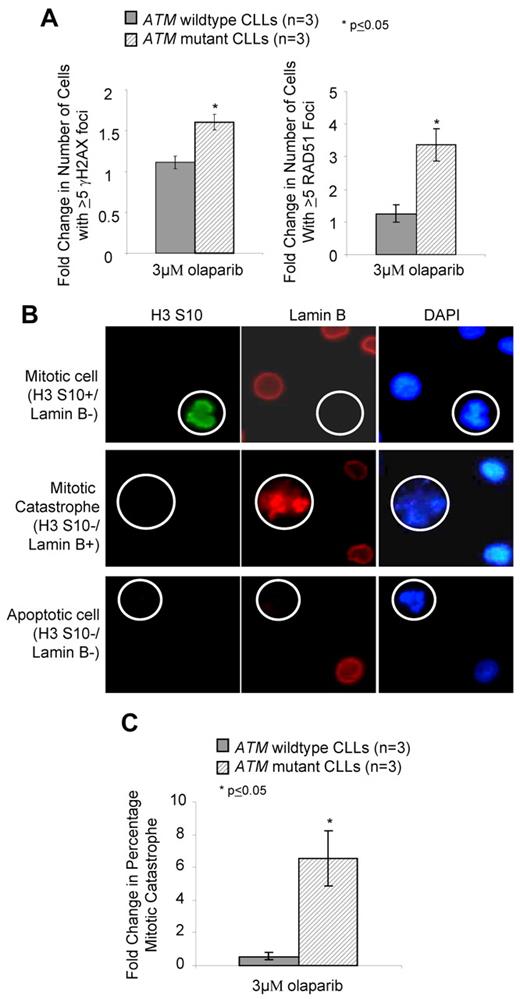 Figure 4. Olaparib induces DNA damage and mitotic catastrophe in ATM mutant lymphoid cells. (A) Induction of γH2AX (left) and RAD51 (right) foci after 7 days exposure to 3μM olaparib measured by immunofluorescence. (B) Differential immunofluorescent staining of cells undergoing normal mitosis (positive for H3 ser-10 phosphorylation and negative for Lamin B), mitotic catastrophe (nega-tive for H3 serine-10 and positive for Lamin B), and apoptosis (negative for both H3 serine-10 and Lamin B), shown at original magnification ×500. (C) Induction of mitotic catastrophe determined by immunofluorescence-based morphologic analysis after 72 hours exposure to 3μM olaparib.