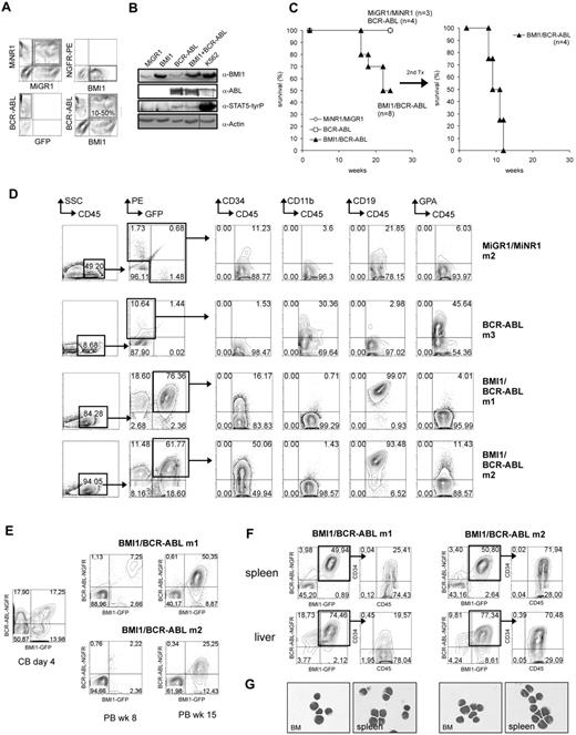 Figure 1. Introduction of BCR-ABL and BMI1 in human cord blood CD34+ cells induces lymphoid leukemia upon transplantation in NOD/SCID mice. (A) Cord blood CD34+ cells were transduced with MiGR1 and MiNR1 empty vector controls, with MiGR1 BMI1 or MiNR1 BCR-ABL vectors, or cotransduced with both vectors (BMI1/BCR-ABL). Efficiencies after 3 transduction rounds are shown. (B) Expression of BMI1, BCR-ABL, and phosphorylated STAT5 was analyzed by Western blotting of transduced CB CD34+ cells. A vertical line has been inserted to indicate a repositioned gel lane. (C) Transduced CB CD34+ cells were transplanted into sublethally irradiated NOD/SCID mice, and Kaplan-Meier survival curves are shown. BM of 2 mice was used for secondary transplantation into sublethally irradiated NOD/SCID mice in duplicate, and Kaplan-Meier survival curves of these mice are shown as well. (D) FACS analysis of BM of engrafted NOD/SCID mice at week 16. (E) Transduced CB CD34+ cells were transplanted into sublethally irradiated NOD/SCID mice, and the percentage of double-positive cells was evaluated directly after transduction and at later time points in the PB of the recipient mice. (F) FACS analysis of the spleen and the liver of the diseased mice showed infiltration of the organs with primitive CD34+ human cells. (G) May- Grünwald Giemsa staining of cytospins from BM and spleen of diseased mice.