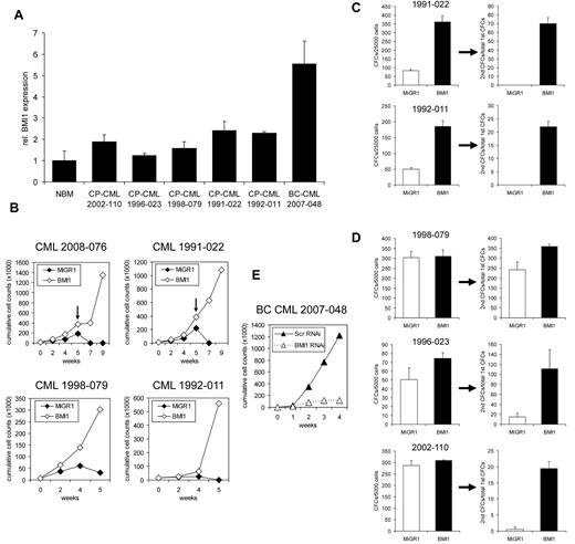Figure 4. Enhanced proliferation of BCR-ABL+ CP CML CD34+ cells by retroviral introduction of BMI1. (A) RNA was isolated from CD34+ cells of CP-CML patients; one BC-CML patient and normal bone marrow (NBM) and BMI1 expression was determined by quantitative real-time polymerase chain reaction. (B) CD34+ cells from CP-CML patients were transduced with control or MiGR1 BMI1 vectors and cells were cultured on MS5 stromal cells, and cumulative cell counts in suspension are shown. Where indicated by the arrows, cultures were harvested and replated onto new stroma. (C) Suspension cells from week 5 cocultures of transduced CP-CML samples were used to perform CFC assays. Progenitor self-renewal was analyzed by replating the cells in secondary CFC assays, and only the BMI1-overexpressing cells had replating ability. (D) CD34+ cells from CP-CML patients were transduced with control or MiGR1 BMI1 vectors, transduced cells were sorted by MoFlo, and CFC frequencies as well as CFC replating capacity were determined in methylcellulose assays. (E) CD34+ cells from a BC CML sample were transduced with lentivirus encoding shRNA sequences against BMI1 or scrambled and then cultured on MS5 stromal cells.