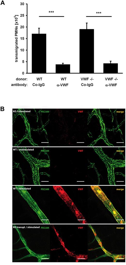 Figure 3. PMN recruitment is independent of platelet-derived VWF and thioglycollate stimulates luminal deposition of endothelial VWF. (A) Mice were lethally irradiated and reconstituted either with wt or VWF-/- donor bone marrow. Peritonitis was induced with thioglycollate. After 2 hours, PMNs were collected and counted in the different groups (n ≥ 5). Error bars show SEM. ***P ≤ .001. (B) Wild-type (WT), VWF−/− (KO), or wild-type mice transplanted with VWF−/− bone marrow (KO transplanted) were injected intraperitoneally with either thioglycollate (stimulated) or PBS (unstimulated). After 1.5 hours, primary labeled anti-PECAM antibodies and nonlabeled anti-VWF antibodies were intravenously injected. After 30 minutes, the vascular system was perfused with PBS to remove unbound antibodies, mesenteries were dissected and stained as whole mounts with a labeled secondary antibody for VWF. Scale bar = 20 μm.
