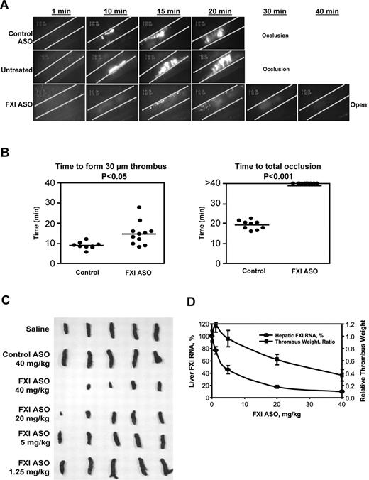 Figure 3. Antithrombotic effect of FXI ASO treatment in mouse models of FeCl3-induced mesenteric vein thrombosis and stenosis-induced IVC thrombosis. Thrombus formation in male BALB/c mice treated with FXI ASO or control ASO (50 mg/kg, subcutaneously) twice weekly for 3 weeks or without treatment (“Untreated”). For testing in the mesenteric vein model, thrombosis was induced by a 3-minute exposure of the mesenteric vein to a 10% FeCl3 solution after intravenous injection of fluorescein-labeled mouse platelets. (A) Continuous recording of venous thrombus formation by intravital microscopy for a total period of 40 minutes or until total occlusion (supplemental Video 1). (B) Time to formation of a 30-μm thrombus or to total occlusion. *P ≤ .05 for FXI ASO-treated group compared with control group. For testing in the stenosis IVC model, 30 male BALB/c mice were treated with FXI ASO (dose ranging from 1.25 mg/kg to 40 mg/kg), control ASO (40 mg/kg), or saline by a twice-weekly subcutaneous injection for a period of 3 weeks. Vena cava thrombosis was induced using a model that combines reduced blood flow with endothelial damage. Twenty-four hours after thrombosis induction, thrombi that had formed in the IVC were collected, fixed in formalin, photographed, and weighed. Thrombus weight relative to saline control mice was calculated. Liver total mRNA was prepared and analyzed for FXI mRNA levels by RT-PCR. (C) The appearance of formed thrombi in the vena cava in different treatment and dosing groups. Thrombus formation in the first mouse of the FXI ASO 40-mg/kg treatment group was completely prevented. (D) Correlation of hepatic FXI mRNA levels and relative thrombus weight in mice treated with FXI ASO at indicated doses.