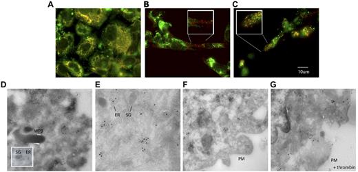 Figure 3. Cellular distribution of PDI in HUVECs. Intracellular localization of PDI was detected by immunostaining of fixed cultured HUVECs with monoclonal antibody RL90. (A) Simultaneous immunostaining of cells for PDI and SERCA2b in HUVECs indicates that these 2 proteins are colocalized in the endoplasmic reticulum. In addition, PDI is observed in granules distinct from the endoplasmic reticulum. Alexa 647–labeled anti-SERCA2b, red; Alexa 488–labeled RL90, green; colocalization, yellow. (B) Simultaneous immunostaining of cells for PDI and VWF indicates that PDI is not stored in Weibel Palade bodies. Alexa 647–labeled goat anti–rabbit IgG was used as a secondary antibody to detect VWF, red; Alexa 488–labeled RL90, green; colocalization, yellow. (C) Simultaneous immunostaining of chemokine Gro-α and PDI shows partial colocalization in small cytoplasmic granules. Original magnification in all panels ×60. Insets show high magnification (×100) of framed areas. (D) Immunogold labeling for PDI (10-nm gold particles) in HUVECs showed PDI in endoplasmic reticulum–related tubulovesicular structures and in small moderately electron-dense granules of approximately 100-150-nm diameter. WPB, Weibel-Palade bodies; ER, endoplasmic reticulum, SG, moderately electron-dense secretory granules (×99 000). (E) PDI and SERCA2b are colocalized in the endoplasmic reticulum, as indicated by immunogold staining. Only PDI is detected in secretory granules (×99 000). F) No plasma membrane–associated signal is detected in resting HUVECs (×119 000). (G) PDI, but not SERCA2b, is bound to the plasma membrane in activated HUVECs (×119 000). PM, plasma membrane. Panels E-G: PDI, 5-nm gold particles; SERCA2b, 15-nm gold particles.