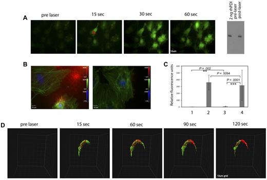 Figure 4. Rapid calcium mobilization and PDI expression after laser injury in vitro and in vivo. Fluo-4-AM (3μM) was incubated with cultured HUVECs before laser injury and observed by fluorescence microscopy. (A) The images show a representative field of cells before and after a direct laser pulse to the point indicated by X. Cell imaging was initiated before laser injury to obtain a baseline image, and the laser was fired during this capture. Increased green signal in subsequent time-lapse images represents increased intracellular calcium monitored by Fluo-4 fluorescence, shown in representative images. The Western blot on the right depicts an immunoblot with polyclonal anti-PDI antibody to detect PDI in conditioned medium from unactivated (lane 2) or laser-activated (lane 3) HUVECs. Lane 1: 2 ng recombinant human PDI. (B) Representative images of fixed and immunostained cells that have been activated by laser injury in the presence of plasma and calcium with (right) or without (left) a function blocking PDI antibody RL90. The cells were fixed after laser activation and stained for fibrin (red). Fluorescein isothiocyanate–phalloidin (green) and DAPI (4,6 diamidino-2-phenylindole; blue). (C) Quantification of fibrin signal detected on cultured endothelial: lane 1, unactivated cells; lane 2, laser-activated cells; lane 3, laser-activated cells in the presence of the PDI-inhibitory antibody RL90; lane 4, laser-activated cells in the presence of an isotype control antibody. The P values between the different groups were obtained using the unpaired t test. (D) Representative images of rapid activation of arteriolar endothelium and PDI expression after laser injury in confocal intravital microscopy. Rhod-2 (6μM) and Alexa 647–labeled polyclonal anti-PDI antibody (0.3 μg/g body weight) were infused 5 minutes before the first injury. Site of injury is indicated by an X. Platelet aggregation was blocked with the GPIIbIIIa antagonist, eptifibatide. Vessel imaging was initiated before laser injury, and the laser was fired after one z-stack of 30 planes was obtained. Each z-stack of 30 images was 8.7 seconds. The grid size was 10 μm. Calcium elevation was monitored by excitation of Rhod-2 at 561 nm (pseudocolored green), while the PDI signal was observed simultaneously at 647 nm (pseudocolored red).