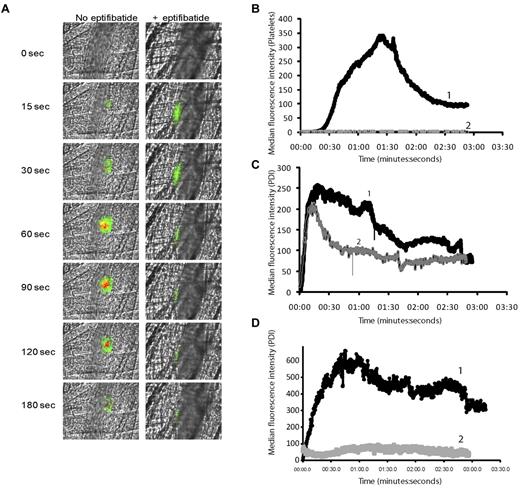 Figure 5. Comparison of PDI expression and platelet accumulation during thrombus formation. Rabbit polyclonal anti-PDI antibody conjugated to Alexa Fluor 488 (0.3 μg/g body weight) and Fab fragments of anti–CD-41 antibody conjugated to Alexa Fluor 647 (0.2 μg/g body weight) were infused into the mouse 5 minutes before arteriolar injury. In certain conditions, eptifibatide (10 μg/g body weight) was infused before injury and reinfused every 20 minutes for subsequent thrombi. (A). Representative binarized images of the appearance of fluorescence signals associated with PDI (green) and platelets (red) over 180 seconds after laser-induced vessel-wall injury in a wild-type (WT) mouse (left panels) or a wild-type mouse treated with eptifibatide. (B) Median integrated platelet fluorescence. Median fluorescence is presented vs. time after vessel-wall injury. Curve 1, WT mice; curve 2, WT mice treated with eptifibatide. (C-D) Median integrated PDI fluorescence detected by rabbit affinity-purified anti-PDI antibody. (D) Wild-type mouse treated with sodium beraprost (30 μg/kg body weight). Curve 1, WT mice; curve 2, WT mice treated with sodium beraprost.
