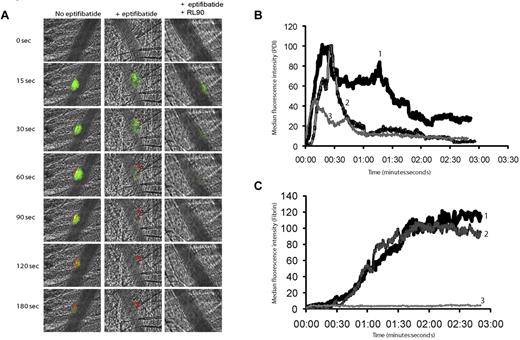 Figure 6. Inhibition of fibrin formation with a function-blocking PDI antibody is platelet independent. Rabbit polyclonal anti-PDI antibody conjugated to Alexa Fluor 488 (0.3 μg/g body weight) and fibrin-specific mouse anti–human fibrin II β-chain monoclonal antibody conjugated to Alexa Fluor 647 (0.5 μg/g body weight) were infused into the mouse 5 minutes before arteriolar injury. (A) Representative binarized images of the appearance of fluorescence associated with PDI (green) or fibrin (red) are shown over 180 seconds after laser-induced vessel-wall injury in a wild-type mouse (left panel), a wild-type mouse treated with eptifibatide (10 μg/g body weight; middle panel), or a wild-type mouse treated with eptifibatide (10 μg/g body weight) and a function blocking anti-PDI antibody, RL90, (2 μg/g body weight; right panel). Inhibitory monoclonal anti-PDI antibody RL90 and/or eptifibatide were infused into the circulation 5 minutes before injury. Data were collected from the same mouse pre- and postinfusion of eptifibatide and/or RL90. (B) Median integrated PDI fluorescence intensity or (C) median integrated fibrin fluorescence intensity for thrombi formed before (curve 1) or after the infusion of eptifibatide (curve 2) or after the infusion of eptifibatide in the presence of RL90 (curve 3). Median fluorescence is presented versus time after vessel wall injury.