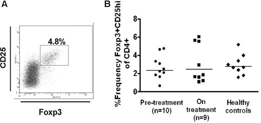 Figure 2. Frequency of CD25hiFoxp3+ in the patient cohort. (A) Whole blood was stained with anti-CD4 peridinin chlorophyll protein and anti-CD25 allophycocyanin, followed by intracellular staining using phycoerythrin-conjugated anti-Foxp3. The cells were first gated on the CD4+ lymphoid population in peripheral blood mononuclear cells, and the frequency of CD25hiFoxp3+ cells was measured based on the shown gating strategy. (B) Percentage of CD25hiFoxp3+ in the CD4+ population in patients before (●) and on treatment with thrombopoietic agents (■) as well as the normal healthy controls (♦). No statistical differences among the groups were seen.