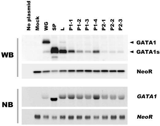 Figure 1. Effects of mutant transcripts of GATA1 on the expression level of the truncated protein. The GATA1 mutations observed in TAM patients are classified according to the types of transcripts. The translational efficiency of each transcript was assessed by Western blot analysis in BHK-21 cells transfected with GATA1 cDNA expression vectors (top part of the panel) and Northern blot analysis (bottom part of the panel), respectively. WG indicates wild type GATA1; SP, splicing error mutation (Δexon 2); L, loss of first methionine mutation; P1, PTC type 1 mutation; P2, PTC type 2 mutation. The details of the GATA1 mutations are summarized in Table 1. NeoR indicates Neomycin phosphotransferase II.