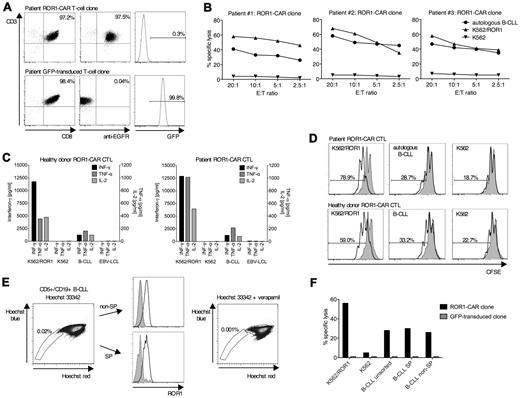 Figure 5. ROR1-CAR transduced CD8+ T cells obtained from B-CLL patients specifically recognize autologous tumor cells. (A) Phenotype and transgene expression of a ROR1-CAR and a GFP-transduced CD8+ T-cell clone obtained from a B-CLL patient. Data are representative for results obtained in 3 B-CLL patients. (B) ROR-CAR CD8+ T cells from 3 B-CLL patients specifically recognize autologous primary B-CLL and ROR1-positive tumor cells by chromium release assay. Cytotoxicity data are presented as mean values of triplicate wells. The standard deviation of each triplicate was ≤ 3% in all cases (B,F). (C) Secretion of INF-γ (left axis), TNF-α and IL-2 (right axis) of ROR1-CAR transduced CD8+ T cells obtained from a healthy donor and a B-CLL patient in response to primary (autologous) B-CLL and ROR1-positive tumor cell lines after incubation for 24 hours at an E:T ratio of 2:1 quantified by Luminex Assay. (D) Proliferation of ROR1-CAR expressing CD8+ T cells obtained from a healthy donor and a B-CLL patient after stimulation with primary (autologous) B-CLL and ROR1-positive tumor cell lines assessed by CFSE dilution after incubation for 72 hours at an E/T ratio of 2:1. Specific proliferation (black solid line) versus background proliferation (gray histogram). (E) Detection of a side population of Hoechst 33342 effluxing B-CLL cells by flow cytometry after staining of primary B-CLL cells with Hoechst 33342 (left dot plot). Expression of ROR1 on SP and non-SP B-CLL cells (center histograms). Inhibition of Hoechst 33342 efflux by addition of 50μM verapamil (right dot plot). Data are representative for results obtained in 3 B-CLL patients. (F) Specific and equivalent elimination of sort-purified SP and non-SP primary B-CLL cells by ROR1-CAR transduced CD8+ T cells by chromium release assay at an E/T ratio of 20:1.