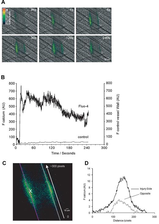Figure 1. Activation of arteriolar endothelium in vivo by laser-induced injury. The endothelium of the cremaster microcirculation was loaded with either Fluo-4 AM or DIOC6 by systemic infusion of Fluo-4 AM/Cremophore or DIOC6 via the femoral artery. A period of 20 minutes was allowed after infusion for uptake and de-esterification of Fluo-4 AM or uptake of DIOC6 within the endothelium. Concurrently platelet accumulation was inhibited by infusion of eptifibatide. After laser-induced vessel wall injury, changes in endothelial Ca2+ levels were observed by excitation at 488 nm. (A) Representative composite fluorescence and brightfield images after vessel injury show Ca2+ elevation in the endothelium in the absence of platelet accumulation. The fluorescence signal is presented as a pseudocolor intensity map where blue represents the least intense and red represents most intense fluorescence signal. (B) Calcium elevation after vessel injury as determined by the median integrated fluorescence intensity (y-axis) from Fluo-4–loaded endothelium (top black curve, 27 thrombi from 3 mice) in comparison to the median integrated fluorescence of the inert dye DiOC6 (bottom gray curve, 15 thrombi from 3 mice). (C) Propagation of Ca2+ elevation and endothelial activation along the vessel after injury is presented as a pseudocolor intensity map as in panel A. Image is representative of peak endothelial activation, the site of injury is marked (X) and one line demarking the vessel wall on the same side as the injury (purple) and a second demarking the opposing side (gray). (D) Representative trace from a single experiment showing quantitation of the Fluo-4 fluorescence signal longitudinally along each vessel wall. A line was drawn along each wall and the intensity of the pixels at each step along this line was determined and plotted. The start of the line (0 pixels) is bottom right and the end (∼ 300 pixels) is top left.