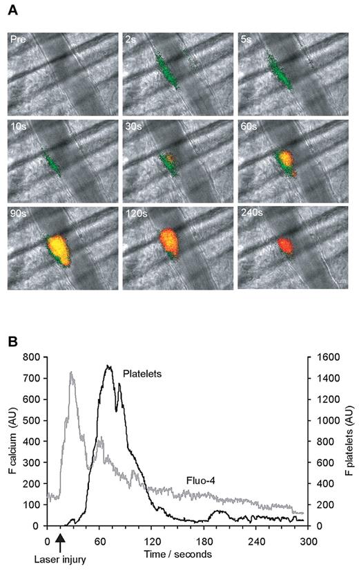 Figure 2. In vivo imaging of platelet accumulation concomitantly with endothelial calcium elevation after laser-induced injury. Platelets were labeled with anti–mouse CD41 Fab fragments conjugated to Alexa 647 infused via the jugular vein, and the endothelium of the cremaster microcirculation was loaded with Fluo-4 AM. After laser-induced vessel wall injury activation of the endothelium and thrombus formation were observed and recorded over time. (A) Composite fluorescence and brightfield images after vessel injury show Ca2+ elevation (green) in the endothelium in conjunction with and preceding platelet accumulation (red) or presence of both signals (yellow). The fluorescence signal is shown binarized for ease of visual interpretation. (B) Kinetic curves displaying the median integrated Fluo-4 fluorescence (gray curve on left y-axis) and median integrated platelet fluorescence (black curve on right y-axis) for 34 thrombi in 3 wild-type mice. Fluo-4 fluorescence originating from platelets and not the endothelium was eliminated by subtracting any Fluo-4 fluorescence in pixels where Alexa 647 fluorescence was observed.