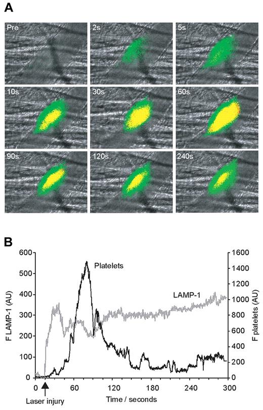 Figure 3. Exposure of activation and secretion marker LAMP-1 in comparison with platelet accumulation in vivo after laser injury. Anti–mouse CD41 Fab fragments conjugated to Alexa 647 and anti–mouse LAMP-1 antibodies conjugated to Alexa 488 were infused to label platelets and LAMP-1, respectively. Injuries were induced by laser pulses to cremaster arteriole vessel walls and subsequent LAMP-1 accumulation and thrombus formation recorded over time. (A) Images from a representative experiment showing fluorescence over time overlaying brightfield data before and after vessel injury. LAMP-1 accumulated rapidly at the vessel wall (green) followed by platelet accumulation (red) or presence of both signals (yellow). The fluorescence signal is shown binarized for ease of visual interpretation. (B) Kinetic curves displaying the median integrated platelet fluorescence (black curve on right y-axis) and median integrated LAMP-1 fluorescence (gray curve on left y-axis) for 18 thrombi in 3 wild-type mice. LAMP-1 fluorescence originating from platelets and not the endothelium was eliminated by subtracting any LAMP-1 fluorescence in pixels where Alexa 647 fluorescence was observed.