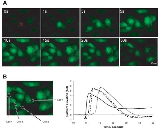 Figure 5. Rapid propagation of endothelial cell activation within a confluent cell population follows laser-induced activation in vitro. HUVECs were loaded with Fluo-4 AM. Cells were observed for 1 minute prior to activation to confirm a stable baseline then subjected to a single pulse from a nitrogen laser and continuous imaging. (A) Images from different time points of a representative cell population. The first frame shows the cell monolayer in its basal state just prior to activation and the X marks the point upon which the laser is focused. The subsequent time points show activation of the target cell (within 1 second of laser firing), closely followed by activation of surrounding cells and then steady return toward a basal cytoplasmic Ca2+ concentration. (B) The mean pixel intensity of the 4 cells is plotted versus time to yield the corresponding 4 kinetic traces shown on the right. Cell 1, solid line; Cell 2, -.-.; Cell 3, - - -; Cell 4, ⋯.