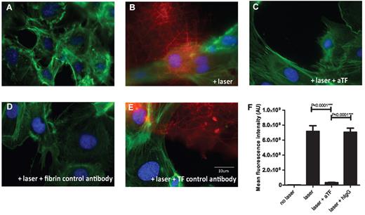Figure 6. Laser activated endothelial cells can induce thrombin generation. HUVECs plated on photo-etched coverslips were loaded with Fluo-4 AM and incubated with plasma in presence of calcium and corn trypsin inhibitor for 15 minutes. Cells were either stimulated with laser or left unstimulated in the presence or absence of various antibodies. After incubation with plasma, cells were fixed and immunostained for fibrin (red), phalloidin (green) and DAPI (blue). (A) Representative images of cells not stimulated by laser and incubated with recalcified plasma show minimal fibrin specific Alexa 647 signal (red). (B) Detection of fibrin-specific signal (red) after laser induced injury of a single cell in a field in presence of recalcified plasma. (C) Representative image showing lack of fibrin formation after laser injury when the cells were incubated with recalcified plasma containing 100 μg/mL function blocking tissue factor monoclonal antibody cH36. (D) No signal was detected when laser stimulated cells were immunostained with an isotype matched control IgG instead of fibrin antibody in the presence of plasma. (E) Fibrin meshwork was detected on cells activated with laser and incubated with recalcified plasma in the presence of an isotype matched control human IgG instead of the monoclonal antibody cH36. (F) Mean integrated fluorescence signal intensity of fibrin (n = 29). Data are from 2 independently performed experiments. The mean ± SEM is plotted for each group. A background mask was created for all images from panel D. Mean of the maximum signal intensities from 29 images in panel D was used as a constant background number to create a threshold segment mask for all other conditions and integrated fluorescence intensity was calculated. The means of the integrated fluorescence intensity show a significant decrease in fibrin generation when laser stimulated endothelial cells are incubated with recalcified plasma in presence of function blocking tissue factor antibody.