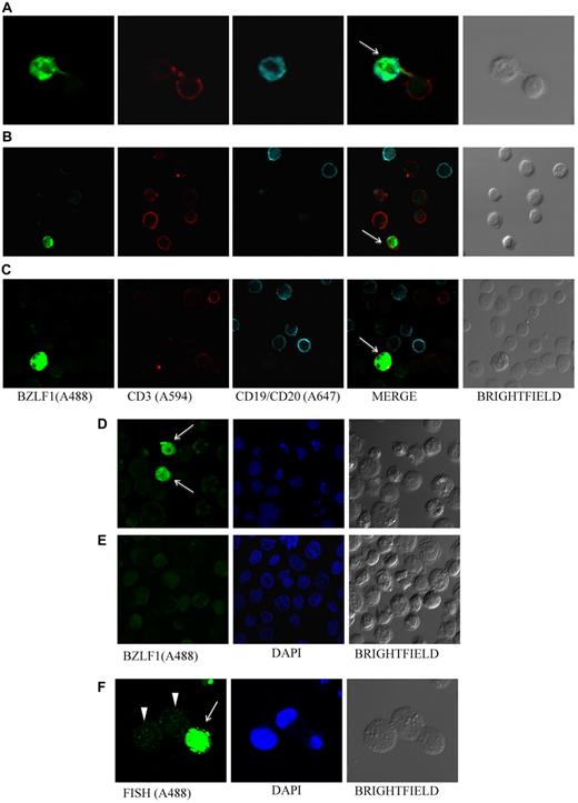 Figure 6. EBV lytic protein BZLF1 is detected in PBMCs. Photomicrographs of PBMCs stained for EBV BZLF1 shows virus lytic infection in B cells (patient 21, A), T cells (patient 12, B), and non-B, non-T cells (patient 26, C). BZLF1 was directly conjugated to Alexa 488. T cells were stained by using Alexa 594–conjugated anti-CD3, and B cells by using a combination of Alexa 647–conjugated anti-CD19 and anti-CD20 antibodies. BZLF1 staining of EBV-positive B95-8 (D) and EBV-negative BJAB (E) cells served as positive and negative controls, respectively, for EBV lytic infection. Arrows indicate BZLF1-positive cells. (F) B95-8 cells stimulated with butyric acid and TPA (phorbol 12-myristate 13-acetate) served as an additional control for lytic infection; cells undergoing lytic infection show a homogeneous pattern with high levels of EBV DNA (arrow), and latently infected cells show a punctate pattern (arrowheads).
