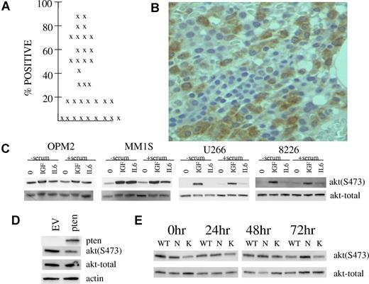 Figure 5. Evidence of in situ TORC2 activation in marrow myeloma cells and possible mechanisms. (A) Percent of myeloma cells positive for phospho-AKT staining in 35 patients. (B) Example of phosphorylated AKT expression in myeloma cells within a bone marrow section. Microscopic visualization was with a Nikon eclipse E400 microscope at 400× magnification and image was captured with a Microfire camera by Optometrics using the Picture Frame program Version 6.1 (Universal Imaging). (C) MM cell lines were stimulated with IGF-1 (250 ng/mL) or IL-6 (1000 U/mL) for 30 minutes after serum depletion overnight or no serum depletion. Immunoblot assay was then performed for phospho-AKT or total AKT. (D) OPM-2 MM cells were infected with adenovirus expressing PTEN or empty vector and, 48 hours later, immunoblot assay was performed for expression of PTEN, phospho-AKT, total AKT or actin. (E) ANBL-6 MM cells stably transfected with mutant N-RAS (N), K-RAS (K) or empty vector (WT) were maintained in continuous culture in 100 U/mL of IL-6. At time 0 hour, all 3 cell lines were depleted of IL-6 for 24, 48, or 72 hours. At each time point, immunoblot assay was performed for expression of phospho-AKT or total AKT. At all time points, there was no significant difference between cell lines in percent viability or viable cell recovery.