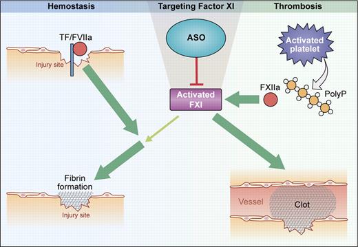 Function of FXI in hemostasis and thrombosis. Hemostasis: At sites of injury, fibrin formation is initiated by the tissue factor (TF)/factor VIIa complex. FXI is activated by thrombin and contributes to sustained fibrin production when TF activity is reduced by reaction with tissue-factor pathway inhibitor (TFPI). Thrombosis: On activated platelet surfaces, released polyphosphates (polyP) initiate contact activation of FXII that, in turn, activates FXI. Further FXI activity is generated by feedback activation. Targeting FXI with ASO abolishes pathologic thrombosis but has minor impact on hemostasis. (Professional illustration by Kenneth X. Probst.)