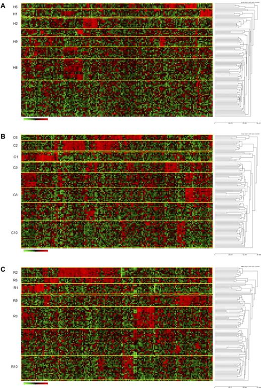 Figure 3. Hierarchical clustering identifies similar clusters in an independent high-risk ALL cohort. Hierarchical clustering using 167 probe sets (provided in supplemental Table 7A) was used to identify clusters of patients with shared patterns of gene expression in a second cohort of high-risk ALL patients previously accrued to COG Trial CCG 1961. Rows indicate 99 patients from COG CCG 1961; and columns, 167 probe sets. Shades of red represent expression levels higher than the median; and green represents levels lower than the median. The cluster groups are prefixed by their method of probe set selection: H indicates high CV; C, COPA; and R, ROSE. (A) HC method for selection of probe sets. (B) COPA selection of probe sets. (C) ROSE selection of probe sets.