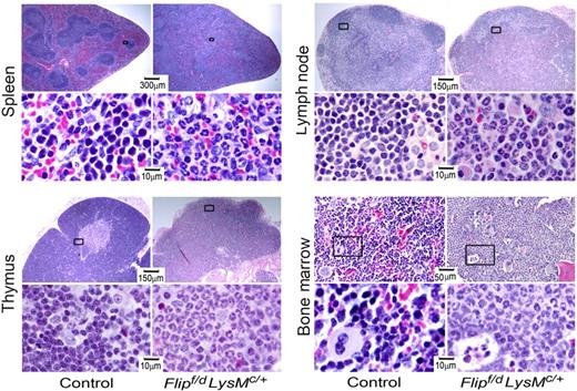 Figure 3. Flip deletion in myeloid linage results in multiorgan neutrophil infiltration. Hematoxylin and eosin staining of representative sections of tissues from the indicated organs from Flipf/d, LysMc/+ and control mice. The area in the box is enlarged in the panel below. Data are representative of sections from 3-4 mice for each group.