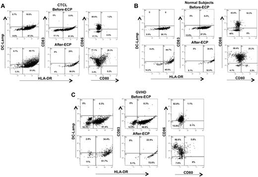 Figure 2. ECP-induction of costimulatory molecules DC-LAMP and class II MHC was determined by flow cytometric analysis of processed monocytes. Monocytes were from (A) CTCL, (B) normal subjects, and (C) GVHD patients. Forward and side scatter gating, confirmed by CD11c and CD14 staining, was used to identify the monocyte population. The cells were fixed and permeabilized and the monocyte/DC population was stained for HLA-DR (FITC) on the membrane and CD83 or DC-LAMP (phycoerythrin, PE) in the cytoplasm to identify differentiating DCs. Two-color membrane staining for CD80 (FITC) and CD86 (PE) was used to identify expression of costimulatory molecules. Results are presented from 1 representative subject per group.