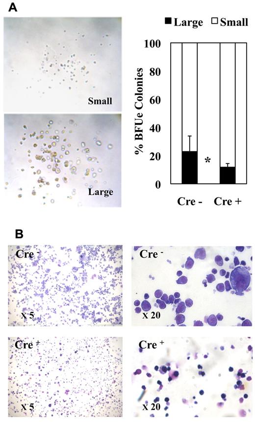 Figure 4. Fli-1 gene deletion decreases the size and enhances the differentiation of MEP-derived erythrocytic colonies. Equivalent numbers of bone marrow MEPs purified from injected Cre− or Cre+ mice have been cultured for 1 week in methylcellulose-medium containing a complete cocktail of cytokines (IL3, IL11, TPO, EPO, SCF, GM-CSF, Flt3-l). (A) Left part, light microscopy view of typical large and small erythrocytic colonies obtained; right part, histogram showing the relative proportions of large and small erythrocytic colonies generated by Cre− or Cre+ MEPs (means and SDs from 3 different couples of fli1fl/fli1Δ Cre+ and Cre− mice). Statistically significant difference is indicated by asterisk. (B) Representative field of May-Grünwald-Giemsa–stained cytospins from pooled Cre− or Cre+ colonies at 5× magnification (left) and 20× magnification (right). Note the increased proportion of small acidophilic mature cells versus large basophilic immature erythrocytic cells in Cre+ compared with Cre− colonies.