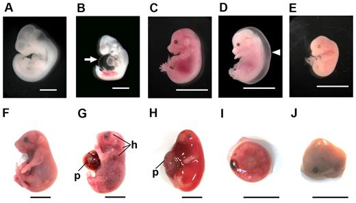Figure 3. Various embryonic abnormalities at different stages due to LPA4 deficiency. Mouse embryos at different developmental stages (E10.5, A-B; E14.5, C-E; E18.5, F-J) were macroscopically observed. Whereas many LPA4-deficient embryos appeared normal, like WT embryos (A,C,F), some mutant embryos had phenotypic abnormalities as follows: effusions in the pericardial space (arrow) at E10.5 (B), severe edema (arrowhead) (D), fragile embryo (E) at E14.5, subcutaneous hemorrhage (h) (G-H), edema (H), retained placenta (I), and macerated embryo (J) at E18.5. In panels G and H, embryos have placentas (p). Scale bars, 1 mm in panels A-B; 10 mm in panels C-J.