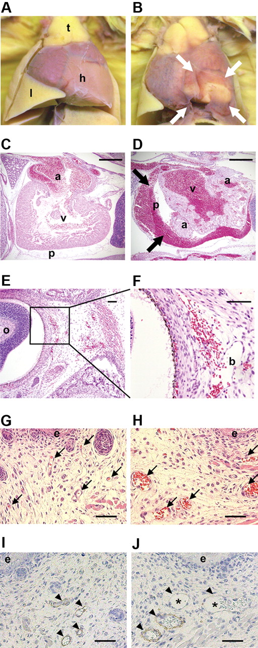 Figure 4. Abnormal and dilated blood vessels with bleeding in LPA4-deficient embryos. (A-B) The hearts from WT (A) and LPA4-deficient (B) embryos at E18.5 were examined macroscopically. Pericardial hemorrhage was observed only in the LPA4-deficient embryos (B, white bold arrows). Note that a cut was made in the blood-stained pericardium in panel B. h, heart; l, lung; t, thymus. (C-D) H&E staining was performed on heart sections of WT (C) and LPA4-deficient (D) embryos at E18.5. In LPA4-deficient embryos, blood cells had leaked into the pericardial cavity (D, black bold arrows). a, atrium; p, pericardium; v, ventricle. Scale bars, 500 μm. (E-F) H&E staining was performed on periocular tissue sections of LPA4-deficient embryos at E18.5 (E). The framed square area in panel E is magnified in panel F. In LPA4-deficient embryos with subcutaneous hemorrhage, red blood cells had leaked into the mesenchyme from a blood vessel. o, oculus; b, blood vessel. Scale bars, 200 μm. (G-H) H&E staining was performed on ventral skin sections of WT embryos (G) and LPA4-deficient embryos with subcutaneous hemorrhage (H) (as shown in Figure 3G) at E18.5. Blood vessels containing red blood cells are indicated by arrows. The bleeding LPA4-deficient embryos (H) had dilated blood vessels compared with WT embryos (G). e, epidermis. Scale bars, 500 μm. (I and J) Immunohistochemical staining for α-SMA was performed on ventral skin sections of WT embryos (I) and LPA4-deficient embryos with subcutaneous hemorrhage (J) at E18.5. Blood vessels containing red blood cells are indicated by arrowheads. Most WT blood vessels were covered with α-SMA+ cells, while some of the dilated blood vessels (asterisks) in LPA4-deficient embryos were poorly covered with α-SMA+ cells. e, epidermis. Scale bars, 500 μm.