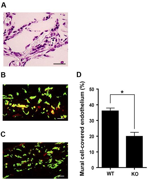 Figure 5. The importance of LPA4 in angiogenesis as evaluated by Matrigel plug assay. (A) An H&E-stained section prepared from a Matrigel plug. Erythrocytes are seen in a cavity that traces the shape of the endothelium-lined vessels. Scale bar, 50 μm. (B-C) Matrigel plug sections immunohistochemically stained for PECAM1 (green) and α-SMA (red). Representative staining of Matrigel plug sections obtained from WT (B) and KO (C) mice are shown. KO, LPA4-deficient. Scale bars, 50 μm. (D) Quantification of mural cell-covered endothelium. Data represent the mean ± SEM (n = 18 from 3 mice in each group). *P < .0001, using Mann-Whitney U test.