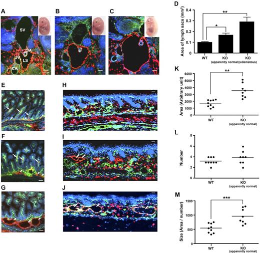 Figure 6. Abnormal and dilated lymphatic vessels with edema in LPA4-deficient embryos. (A-C) Transverse sections of the jugular area, including typical lymphatic sacs that surround the subclavian arteries, were immunostained with antibodies against PECAM1 (green), LYVE1 (red), and TOTO-3, a nuclear marker, (blue) in WT (A), apparently normal LPA4-deficient (B), and edematous LPA4-deficient (C) embryos at E14.5. SV, subclavian vein; SA, subclavian artery; CA, carotid artery; JV, jugular vein; LS, lymph sac. Scale bars, 100 μm. (D) Quantification of the area of lymph sacs in WT, apparently normal LPA4-deficient, and edematous LPA4-deficient embryos. Data represent the mean ± SEM (n = 13, 10, and 9, respectively). *P < .05 and **P < .001, using Kruskal-Wallis test followed by Dunn post-hoc test. KO, LPA4-deficient. (E-J) The ileum (E-G) and the skin (H-J) were immunostained with antibodies against PECAM1 (green), LYVE1 (red), and TOTO-3 (blue) in WT (E,H), apparently normal LPA4-deficient (F,I), and edematous LPA4-deficient (G,J) embryos at E18.5. Arrowheads, submucosal lymphatic vessels; arrows, subserosal lymphatic capillaries (lacteals); double arrowheads, severely dilated lymphatic vessels. Scale bars, 50 μm. (K-M) Quantification of area, number, and size ( = area/number) of the skin lymphatic vessels, respectively, in WT and apparently normal LPA4-deficient embryos. Data represent the mean ± SEM (n = 9 and 8, respectively). *P < .005 and **P < .0001, using unpaired 2-tailed t test.