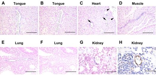 Figure 7. Expression of Lpa4 mRNA in some blood vessels. (A-G) In situ hybridization of Lpa4 mRNA. The antisense probe was used in panels A,C-E,G. A positive signal was present in the peripheral vasculatures but not in the large blood vessels (C, upper right). In panels B,F, the sense probe was hybridized to serial sections of A and E, respectively, as negative controls. Little or no signal was observed. Nuclei were counterstained with Kernechtrot. (H) Immunohistochemistry for VWF counterstained with Mayer's hematoxylin. This was a serial section of panel G. Panels A-D,G-H were tissue sections from embryos at E18.5, while panels E-F were from embryos at E12.5. Lpa4 mRNA expression can be seen in the peripheral vasculatures of the tongue (A), heart (C), muscle (D), lung (E), and kidney (G). Scale bars, 200 μm in panels A-F and 50 μm in panels G,H.