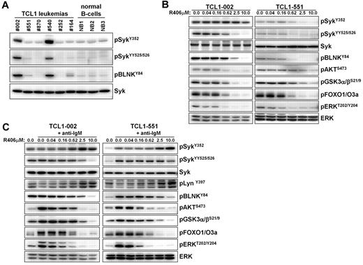 Figure 1. Analysis of Syk activity and BCR signaling in TCL1 leukemias in vitro. (A) The presence of active Syk protein was investigated by immunoblotting analysis with phospho-specific antibodies on cellular extracts prepared from spleens of mice with TCL1 leukemias. Normal B cells that were purified by negative selection from spleens of wild-type mice were used as controls. (B) Freshly isolated TCL1 leukemia cells were cultured for 90 minutes in the presence of the indicated concentrations of R406. The effect on the basal activity of signaling molecules downstream of Syk was investigated by immunoblotting analysis using phospho-specific antibodies. Syk and ERK served as loading controls. (C) TCL1 leukemia cells were preincubated for 90 minutes with the indicated concentrations of R406 prior to stimulation with anti-IgM antibody for 3 minutes. Cells were collected and analyzed as above.