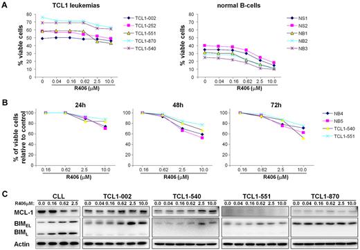 Figure 2. Sensitivity of TCL1 leukemias to R406-induced apoptosis in vitro. (A) TCL1 leukemia cells were cultured for 48 hours with increasing concentrations of R406. The rate of apoptosis was determined by Annexin V/PI staining. Samples NB1, NB2, and NB3 are normal B cells that were purified by negative selection from the spleens of wild-type mice; samples NS1 and NS2 are mononuclear cells obtained from the spleens of the same animals. (B) Time-course analysis of in vitro sensitivity to R406. The percentage of viable cells relative to control (no R406) was determined in 2 TCL1 leukemias (TCL1-540 and TCL1-551) and 2 normal B-cell samples (NB4 and NB5) after 24, 48, and 72 hours incubation with the indicated concentrations of R406. (C) Human CLL cells and TCL1 leukemia cells were cultured for 48 hours in the presence of the indicated concentrations of R406. Protein extracts were analyzed for changes in the expression of Mcl-1 and Bim by immunoblotting. Actin served as a loading control.