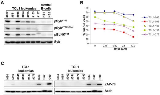 Figure 7. Syk activity, sensitivity to R406-induced apoptosis, and ZAP-70 expression in TCL1 leukemias treated with R788. (A) Leukemic cells were isolated from the spleens of Eμ-TCL1 transgenic mice 1-2 months after treatment with R788 had been discontinued. TCL1 leukemias that were used in the adoptive-transfer experiments (TCL1-002 and TCL1-551) and normal B-cell samples (NB1 and NB2) were loaded as controls. Syk activity was evaluated by immunoblotting analysis with phospho-Syk and phospho-BLNK antibodies. (B) Percentage of viable leukemic cells (annexin V/PI negative) after 48 hours in culture with R406. (C) Immunoblotting analysis of ZAP-70 expression in TCL1 leukemias. Leukemia cells were purified by negative selection, the percentage of remaining T cells after purification was less than 3%. Negative controls included 2 normal B-cell samples purified by positive selection from spleens of wild-type mice (NB4 and NB5) and 1 ZAP-70–negative CLL sample (G57). Positive controls were the mouse T-cell line B3Z and 1 ZAP-70–positive CLL sample (G90). The CLL samples were purified by negative selection, as described elsewhere.15 Actin served as a loading control.