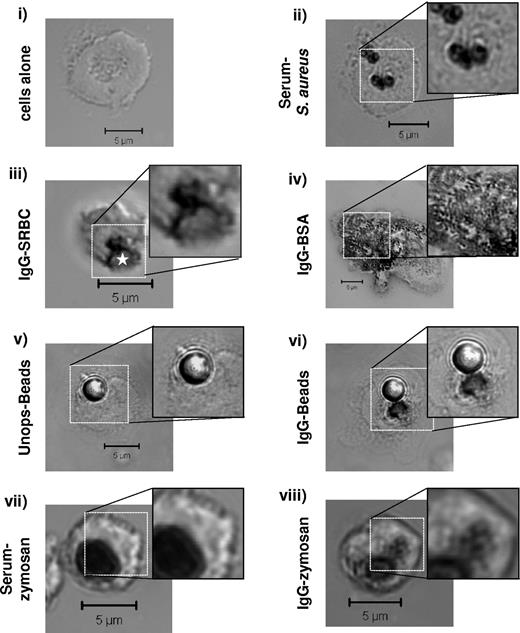 Figure 1. IgG-dependent extra-phagosomal ROS production. Primed WT mouse bone marrow–derived neutrophils (BMNs) were preincubated with NBT, left untreated (i), or incubated with serum-opsonized S aureus (ii); IgG-opsonized SRBCs (iii); immobilized immune complex IgG-BSA (iv); unopsonized (v) or IgG-opsonized (vi) latex beads; serum-opsonized (vii) or IgG-opsonized (viii) zymosan, as described in “Phagocytosis assays,” and supplemental Methods. Non-phagocytosed S aureus or SRBCs were lysed before processing. Samples were cytospun (i-ii) or allowed to adhere (iii-viii) onto glass coverslips, fixed in 4% paraformaldehyde, washed, and mounted as described in “Phagocytosis assays.” Dark formazan deposition was detected by DIC imaging on a Zeiss LSM 510 META point-scanning confocal microscope. Shown are representative DIC images, including an enlarged section of formazan deposition under each condition. The IgG-SRBC phagosome is indicated by a white star. Scale bars represent 5 μm.