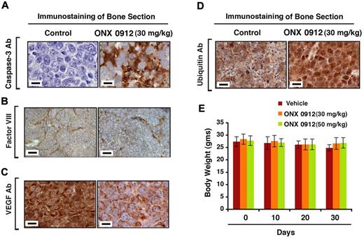 Figure 6. Effect of ONX 0912 on apoptosis, neovascularization, and ubiquitination in vivo in xenografted MM tumors. (A-D) Human bone chips were removed from mice after the last treatment and immunostained with Abs against Caspase-3, Factor VIII, VEGFR1, and Ubiquitin. Scale bar, 10μm. Dark brown represents marker-positive cells in all cases. Micrographs are representative of bone sections from 2 different mice in each group. (E) Mice in vehicle-treated control and ONX 0912–treated groups were weighed every week. The average changes in body weight are shown.