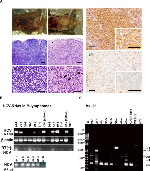 Figure 2. Histopathologic analysis of B-cell lymphomas in RzCD19Cre mouse tissues. (A) Histologic analysis of tissues from a normal mouse (i, iii, v; CD19Cre mouse, ID No. 47-4, male) and a B-cell lymphoma from a RzCD19Cre mouse (ii, iv, vi; ID No. 69-5, male). Paraformaldehyde-fixed and paraffin-embedded tumor tissues were stained with hematoxylin and eosin (iii-vi) or immunostained using anti-CD45R (vii; bottom right, inset) and anti-CD3 (viii; bottom right, inset). Also shown is a macroscopic view of the lymphoma from a mesenchymal lymph node (ii, indicated by forceps), which is not visible in the normal mouse (i). Mitotic cells are indicated with arrowheads (vi). Scale bars: 100 μm (iii-iv, vii-viii) and 20 μm (v-vi, insets in vii-viii). (B) Expression of HCV RNA in B-cell lymphomas from RzCD19Cre mice was examined by RT-PCR. The first round of PCR amplification yielded a 123-base pair fragment of HCV cDNA (upper panel), and a second round of PCR amplification yielded a 65-base pair fragment (lower panel). The β-actin mRNA was a control. As an additional control, the first and second rounds of amplification were performed using samples that had not been subjected to reverse transcription. NTC, no-template control. (C) Ig gene rearrangements in the tumors of RzCD19Cre mice. Genomic DNA isolated from B-cell lymphoma tissues of RzCD19Cre mice (ID Nos. 24-1, 24-4, 54-1, 56-5, 69-5, 31-4, 42-4, 43-4) and spleen tissues of a WT mouse (ID No. 21-2) was PCR amplified using primers specific for Vκ-Jκ genes. Amplification of controls was performed using genomic DNA isolated from a GANP transgenic mouse (GANP Tg#3) and in the absence of template DNA (no-template control, NTC). M, DNA ladder marker.