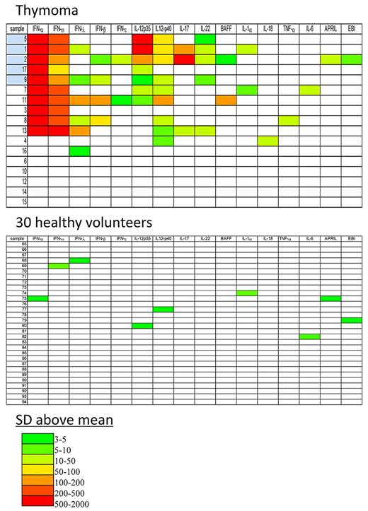 Figure 3. Heatmap analysis of anti-cytokine autoantibody titers for plasma from 17 patients with thymic neoplasia and 30 healthy volunteers. Shown are the 16 cytokines that had any positive result of the 38 cytokines tested. Titer values greater than the mean plus 3 SDs of the 30 healthy volunteers were color-coded from green to red to signify the relative number of SDs above these reference values. The patient codes colored blue indicate the thymoma patients with OI: patients 1 and 5 had CMC, patient 2 had CMC pulmonary M avium and sinopulmonary S apiospermum, patients 1 and 17 had dVZV, and patient 9 had disseminated cryptococcosis.
