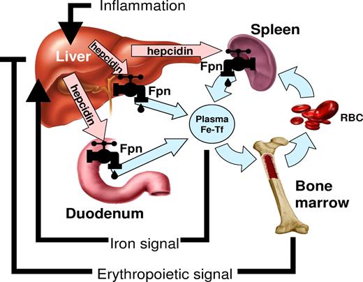 Figure 1. The role of hepcidin in iron metabolism. Hepcidin-ferroportin interaction determines the flow of iron into plasma. Hepcidin concentration is in turn regulated by iron, erythropoietic activity, and inflammation.6