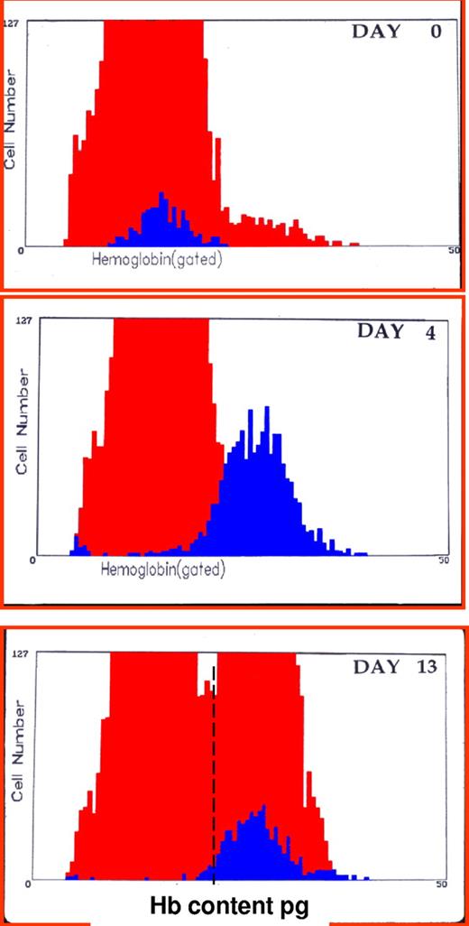 Figure 4. CHr: early indicator of iron deficiency and response to therapy. Histogram of red blood cells (gray area) and reticulocytes (black area) hemoglobin content (picograms per cell) before and 4 and 13 days after intravenous administration of iron dextran in a patient unresponsive to oral iron therapy. Values at day 0 were hemoglobin 7.8 g/dL, mean corpuscular hemoglobin 16 pg, reticulocytes 1.8%, CHr 16 pg. Values at day 4 were hemoglobin 8.7 g/dL, mean cell hemoglobin 17.3 pg, reticulocytes 6.4%, CHr 26 pg. Values at day 13 were hemoglobin 11.2 g/dL, mean cell hemoglobin 20.8 pg, reticulocytes 3.4%, CHr 27.1 pg.2